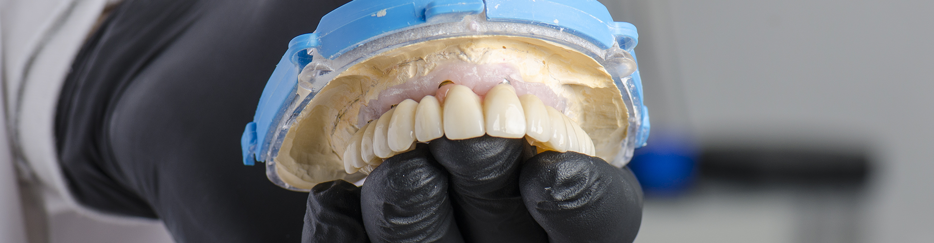gloved hand holding denture